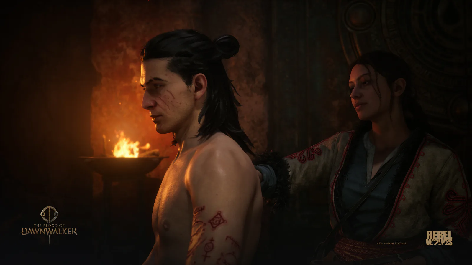 Coen is examined beside a fire in The Blood of Dawnwalker